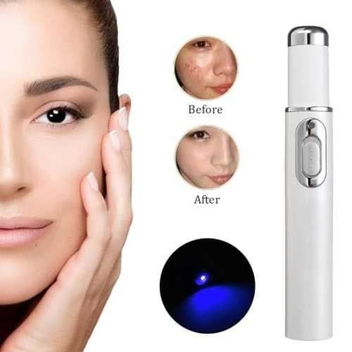 Laser peel, rp 207.500 ; Harga Laser Wajah Content