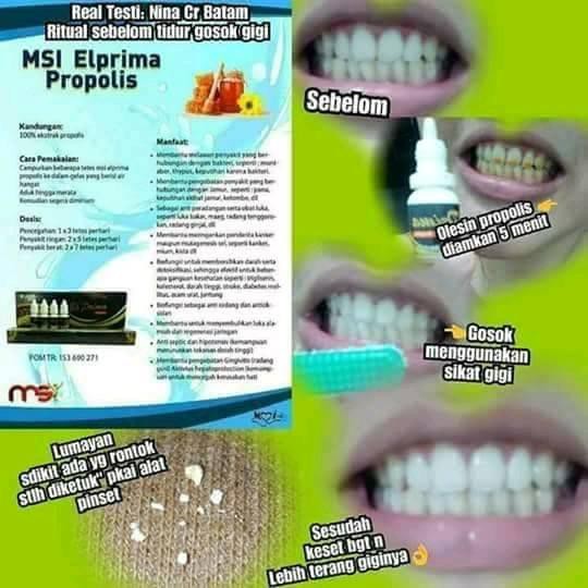 Perontok Karang Gigi Propolis Elprima Harga Perbotol Shopee