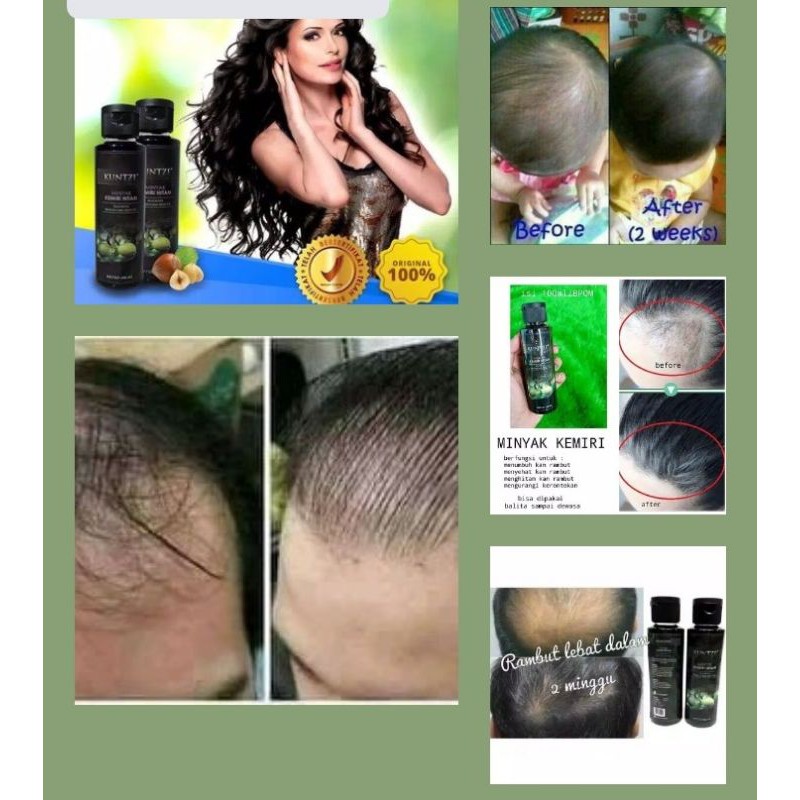 Halo sahabat cantik, kembali bersama saya wilwatikta az zahra, beauty entrepreneur oriflame, kali ini kita akan membahas bagaimana merawat rambut yag rontok . Harga Rontok Rambut Ori Terbaru November 2021 Biggo Indonesia