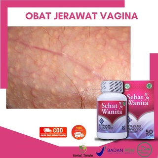 Tetapi varises terkadang terasa berat, menyebabkan gatal, atau berdarah. Jual Obat Infeksi Jamur Vagina Gatal Bagian Dalam Miss V Perih Nyeri Saat Berhubungan Perih Saat Pipis Vagina Berlendir Keputihan Parah Keputihan Menggumpal Keluar
