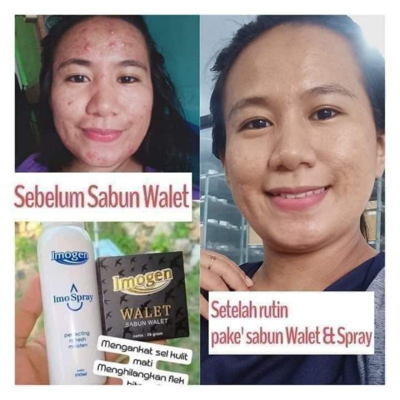Saya baru kali ini pakai sabun konjisan. Harga Imogen Sabun Walet Terbaru Oktober 2021 Biggo Indonesia