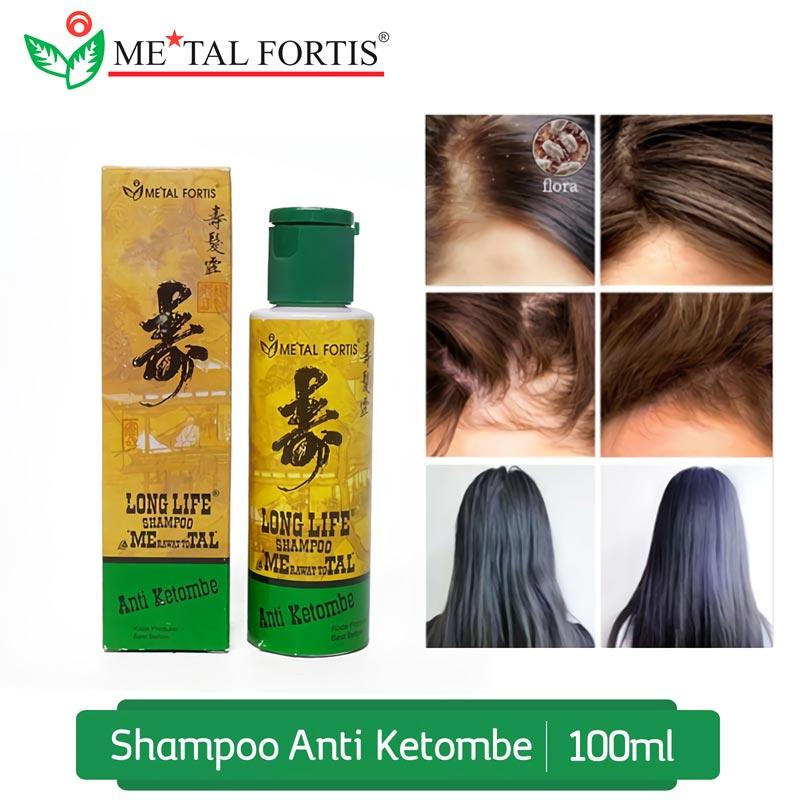 Pusat grosir online mainan anak murah. Promo Shampo Metal Fortis Anti Ketombe Hijau Original Bpom Hasil Maksimal Perawatan Rambut Shopee Indonesia