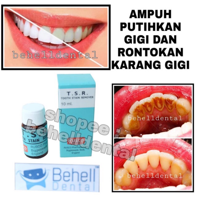 Ori Pemutih Gigi Tsr Ampuh Cepat Terbaik Penghancur Pelunak