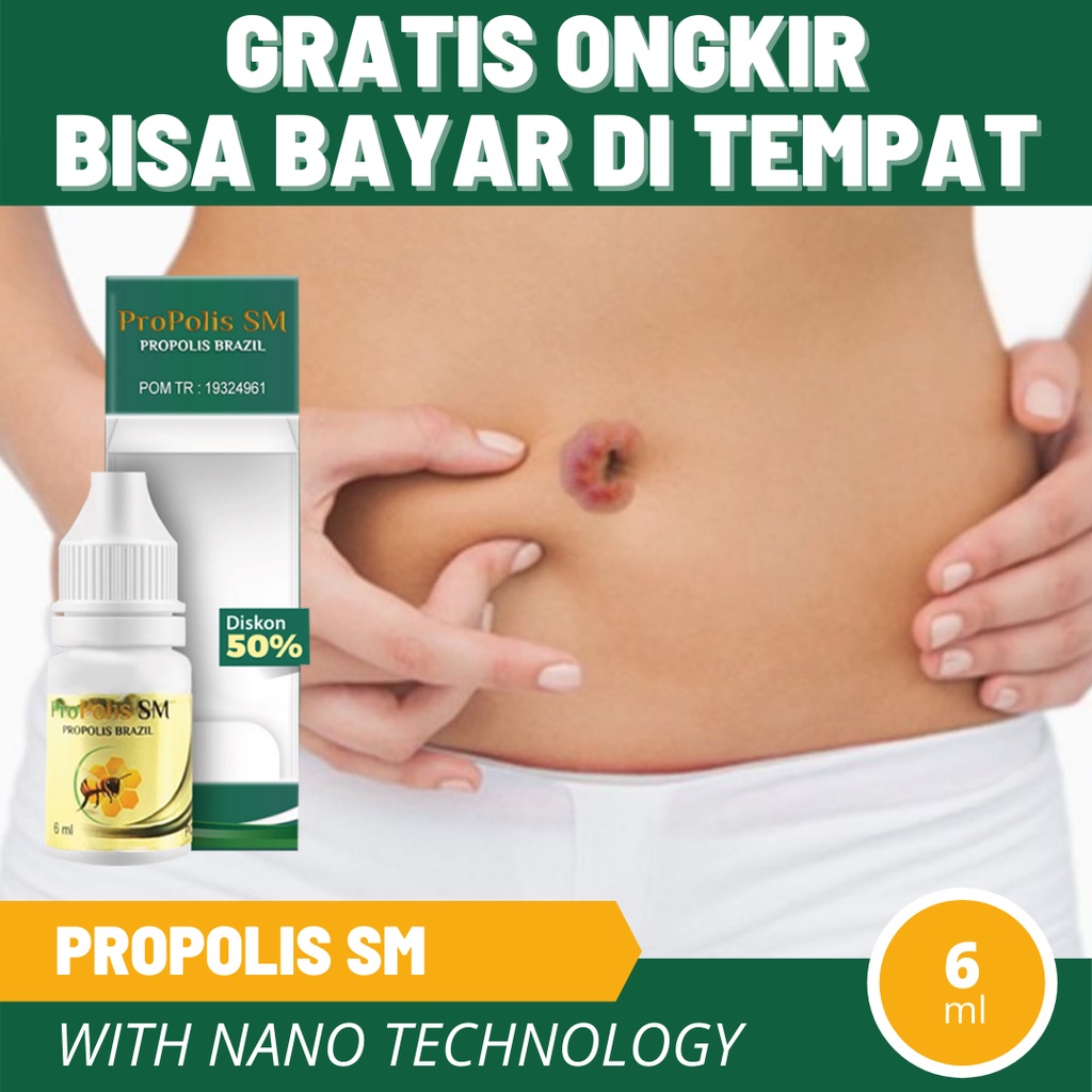 Jual Obat Pusar Bernanah, Infeksi Di Pusar, Pusar Berair, Menghilangkan Bau  Pusar, Pusar Terasa Sakit, Pusar Gatal, Pusar Bau, Pusar Bernanah, Pusar  Berair dan Bau - ProPolis SM Indonesia|Shopee Indonesia