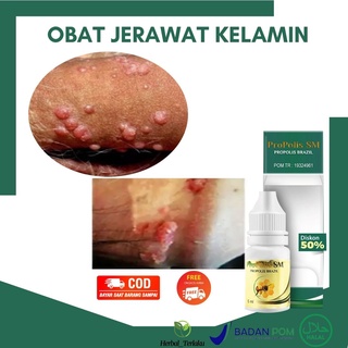 Tanda ini sering kali sulit . Jual Obat Jerawat Folikulitis Di Kelamin Jerawat Di Kemaluan Infeksi Folikulitis Yang Meradang Qnc Indonesia Shopee Indonesia