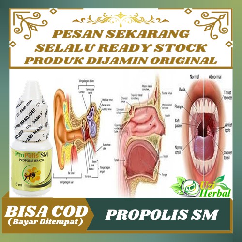 Mulai dari infeksi telinga, radang ginjal, demam rheumatik, . Obat Herbal Penyakit Tht Kelainan Hidung Sakit Tenggorokan Gangguan Telinga Pendengaran Kurang Shopee Indonesia