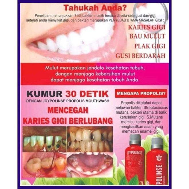 Joypolinse Obat Radang Tenggorokan Kering Shopee Indonesia