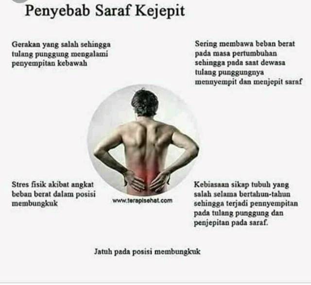 Oksya Nasa Obat Penghilang Sakit Encok Meredakan Nyeri Punggung