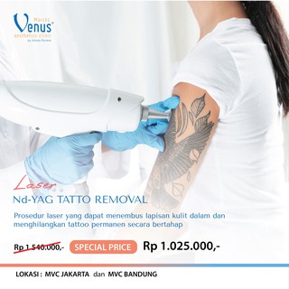 Laser Tattoo Removal Shopee Indonesia