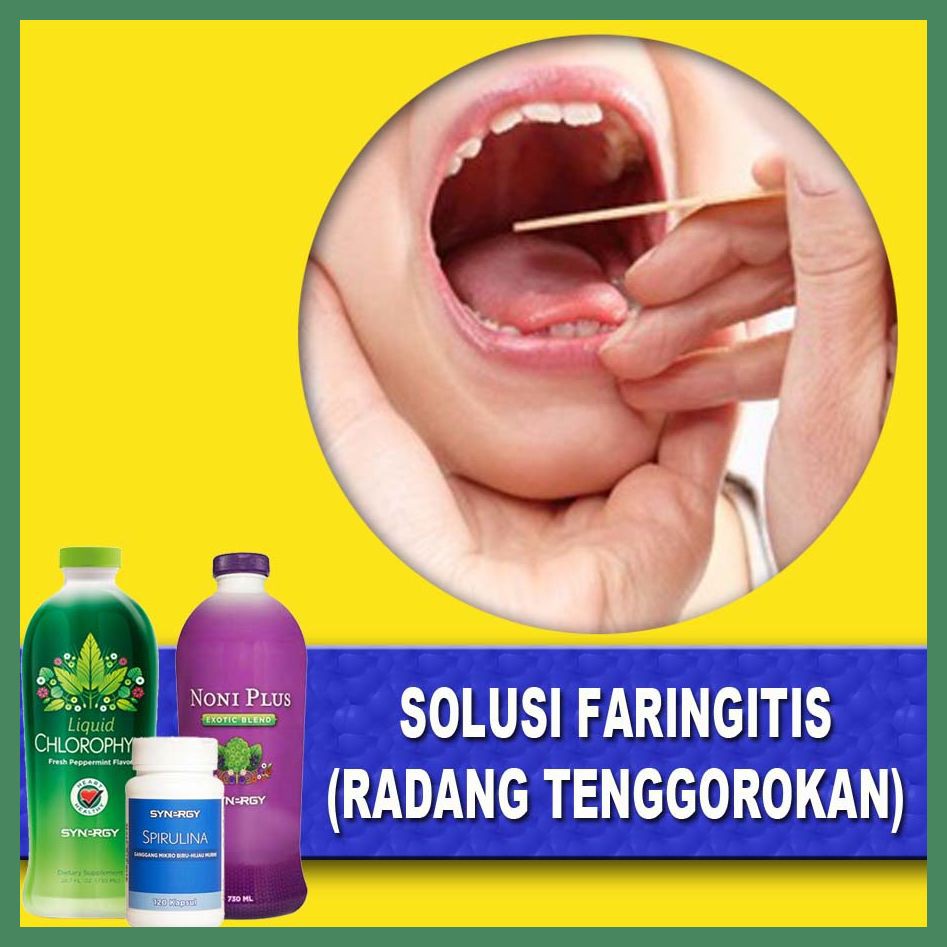 Maxipack Obat Radang Tenggorokan Faringitis Tanpa Resep Dokter 100