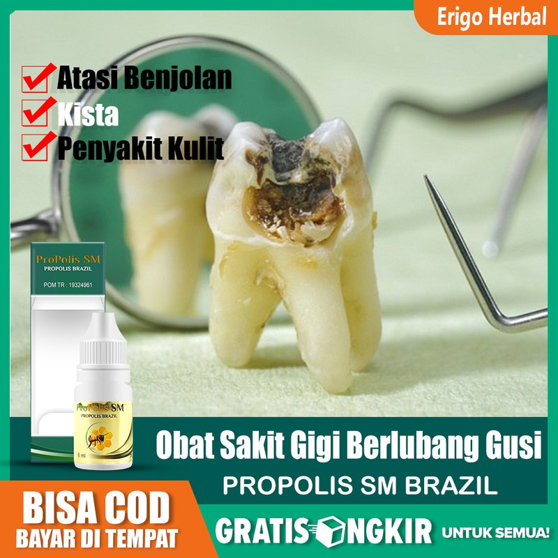 Infeksi gigi berlubang yang menyebar ke gusi sekitarnya. Jual Obat Sakit Gigi Berlubang Penghancur Gigi Berlubang Dan Gusi Terbukti Propolis Sm Di Tangerang Indonesia Shopee Indonesia