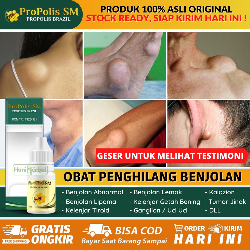 Jangan langsung minum obat, coba cara atasi pembengkakan kelenjar getah bening secara alami · 1. Jual Cara Menghilangkan Benjolan Di Leher Kelenjar Getah Bening Ketiak Belakang Telinga Kepala Tengkuk Punggung Obat Herbal Mengobati Benjolan Abnormal Di Tubuh Penghilang Benjolan Tak Wajar Di Tubuh Propolis Sm Indonesia Shopee Indonesia