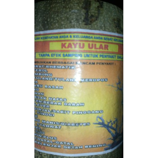 Gigi Berlubang Ini Cara Meredakan Rasa Sakitnya Tanpa Obat