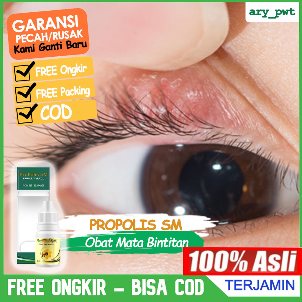 Anda perlu menggosok minyak kelapa dengan . Obat Mata Bintitan Alami Mata Bengkak Sakit Mata Bintitan Benjolan Kelopak Mata Propolis Sm Shopee Indonesia