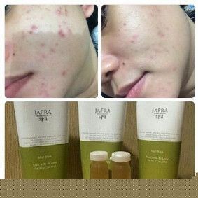 Silt, (licorice) glycyrrhiza glabra extract untuk menipiskan flek dan bekas noda jerawat . Jual Jafra Mud Mask 30g Indonesia Shopee Indonesia