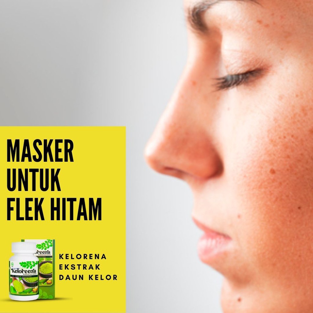 Pembersih muka cowok / obat flek hitam ampuh / menghilangkan . Obat Menghilangkan Flek Hitam Di Wajah Membandel Flek Hitam Di Pipi Hidung Keloreena Flek Hitam Shopee Indonesia