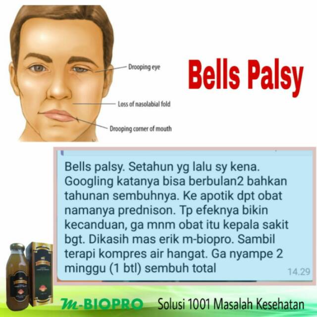 M Bio Pro Herbal Dahsyat Bells Palsy Sembuh Shopee Indonesia