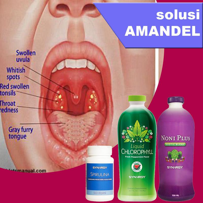 Obat Amandel Herbal Plus Suplemen Daya Tahan Tubuh Anak Dan Dewasa