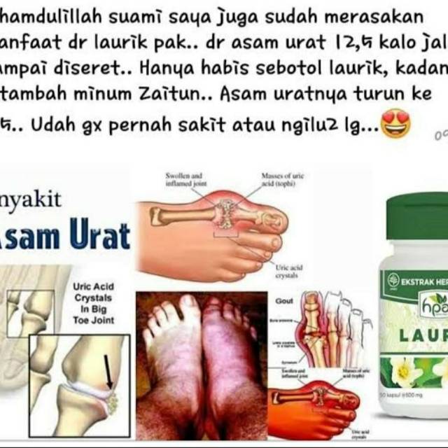 Jual Laurik HNI - Mengatasi masalah Asam Urat/Kibas/kesemutan  Indonesia|Shopee Indonesia