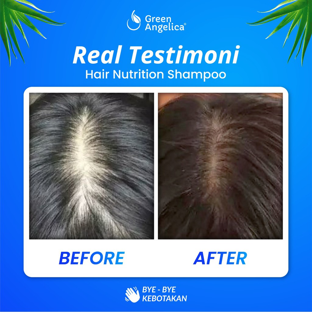 Nah, kali ini ochell bakalan share, . Jual Shampo Rambut Rontok Shampoo Rambut Rontok Parah Rusak Dan Berminyak Terefektif Indonesia Shopee Indonesia