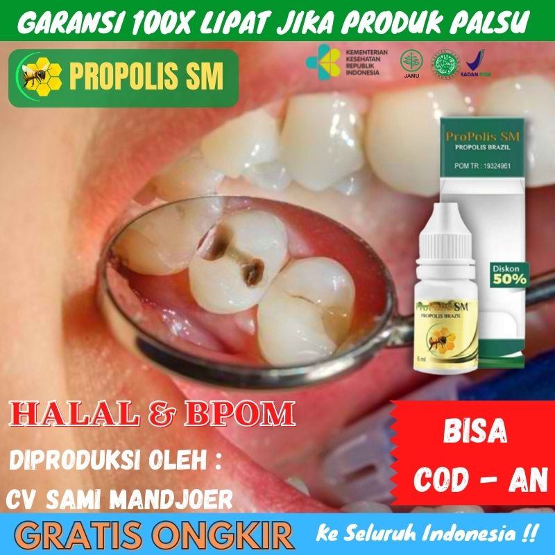 Penyebab gigi berlubang dan perawatannya · tidak lupa untuk menyikat gigi dua kali sehari, yaitu pagi dan malam. Harga Obat Gigi Berlubang Parah Terbaru April 2022 Biggo Indonesia