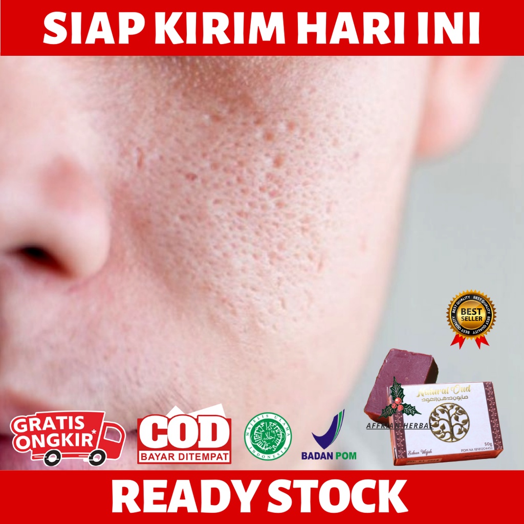 14/8/2017 · manfaat daun kemangi untuk jerawat. Harga Pori2 Besar Terbaru Januari 2022 Biggo Indonesia