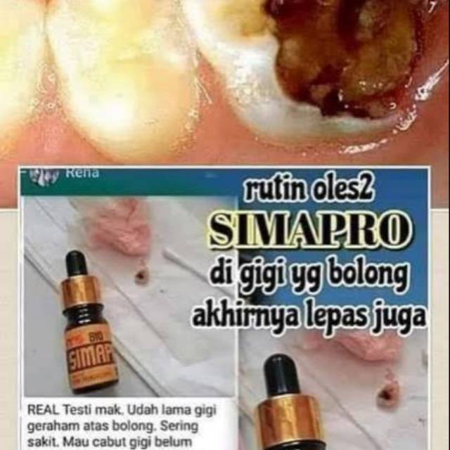 Dokter biasanya akan memberikan obat pereda nyeri ketika . Jual Obat Sakit Gigi Sariyawan Msi Bio Simapro Indonesia Shopee Indonesia