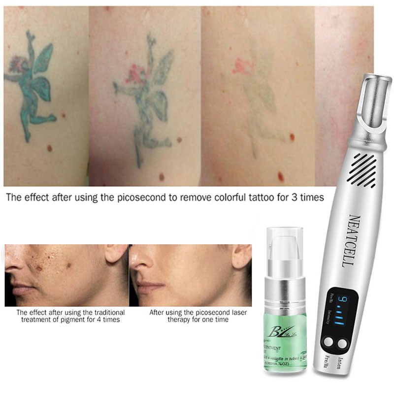 Caneta removedora de tatuagem neatcell Neatcell Picosecond Laser Pen Lively Focus Laser Skin Laser Skin Treatment Skin Spots
