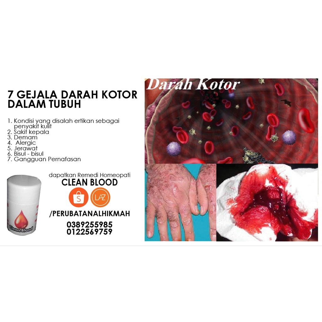 Apalagi jika tidak dihilangkan, noda bintik hitam pada mukena ini akan semakin banyak. Cara Nak Membersihkan Darah Kotor Dalam Badan Lelaki Jared Phillips