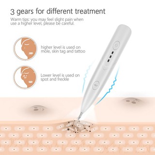 Here's what you need to consider about tattoo removal. Skin Care Laser Pen Mole Tattoo Freckle Removal Pen Sweep Spot Mole Removing Wart Dark Spot