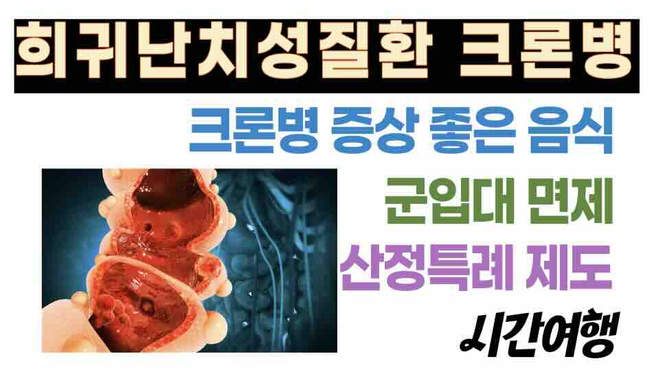 희귀난치성질환 크론병 증상, 좋은 음식, 군입대 면제, 산정특례