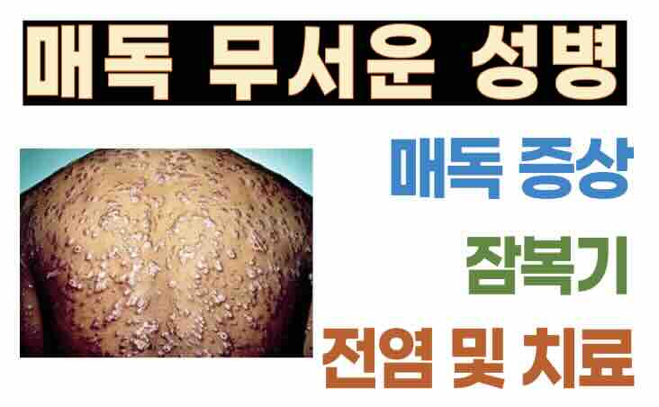 남자 여자 매독 증상 | 잠복기사진 | 전염 | 치료 | 완치