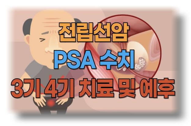 전립선암 수치와 병기 3기, 4기에 대한 이해