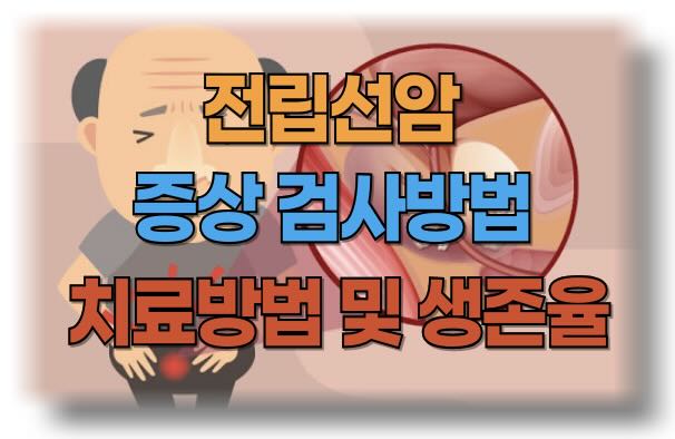 전립선암 주요 증상, 위험 요인, 검사 및 진단방법, 수술 및 생존율