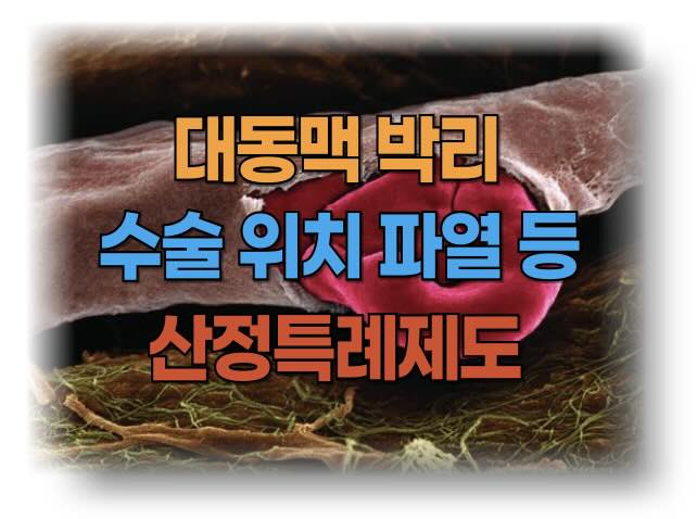 대동맥 박리 수술 위치 등 치료비 절감을 위한 산정특례