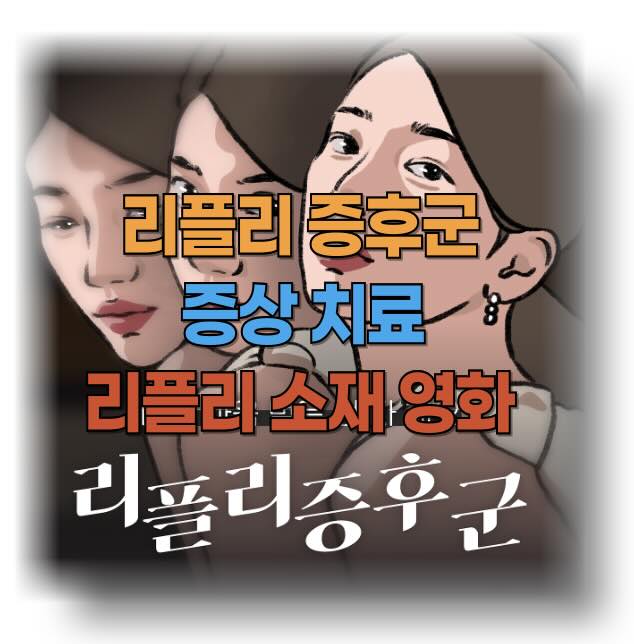 리플리 증후군 증상과 원인, 치료 방법