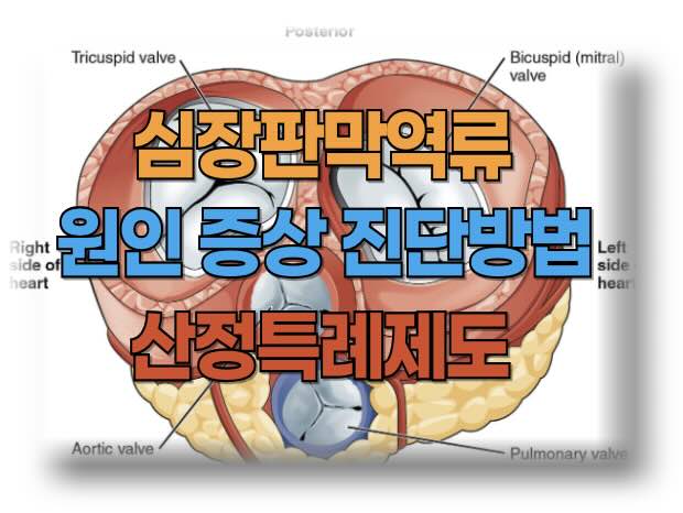 심장판막