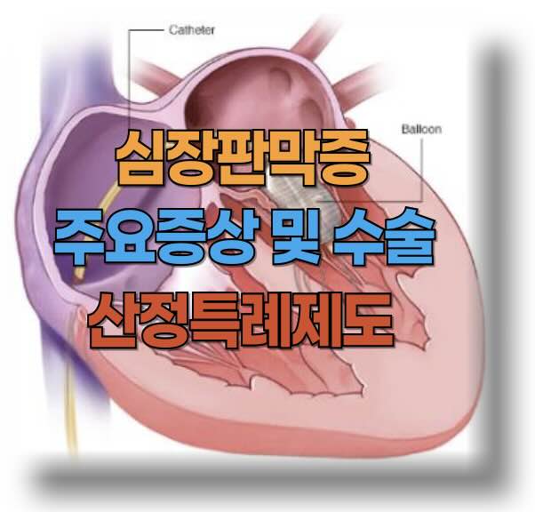 심장판막증 증상 및 수술
