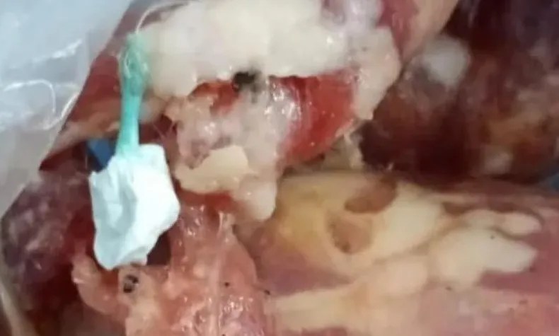 Mujer queda detenida al intentar pasarle droga a un preso adentro de un chorizo