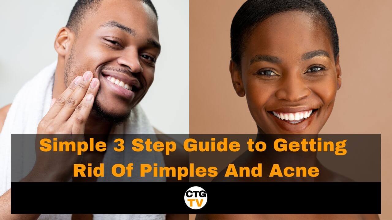 Simple 3 Step Guide to Getting Rid Of Pimples And Acne