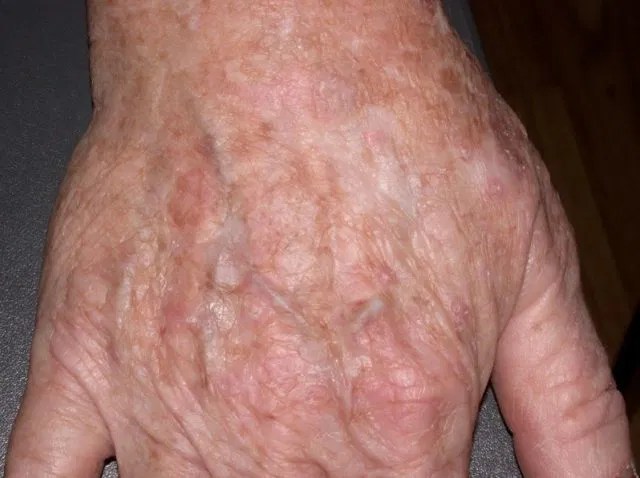 HERE’S WHAT YOU NEED TO KNOW!