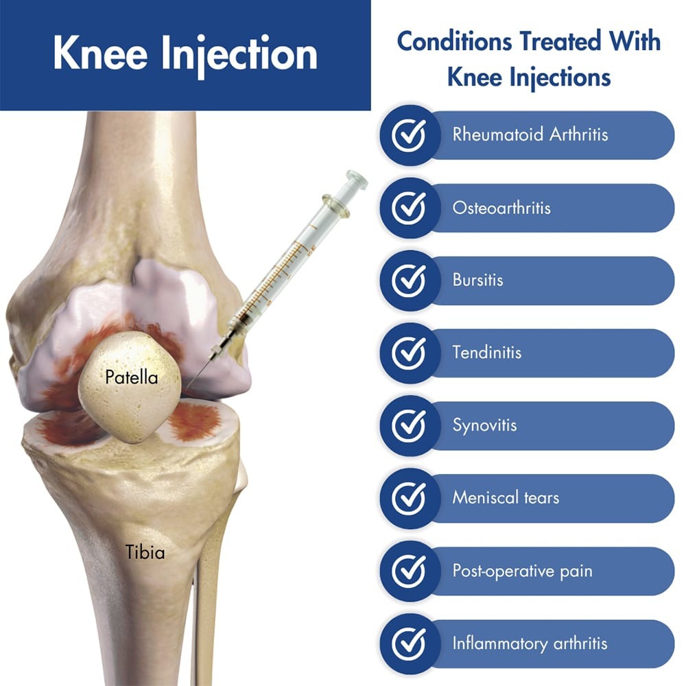 Knee Pain Inject
