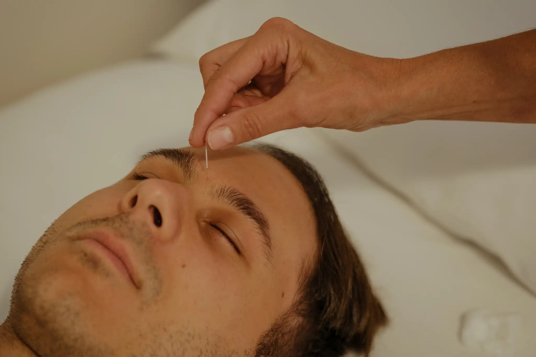 client receiving acupuncture for face