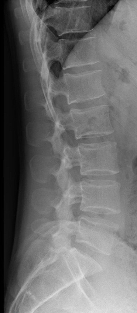How do I know if my back pain is serious