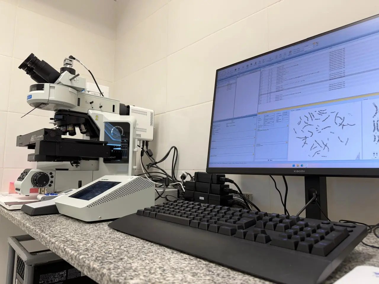 Qué es un cariotipador, la nueva tecnología que sumó el Hospital de Trelew