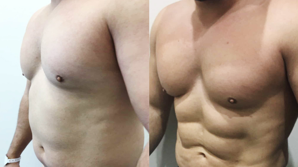 Foto Before After..