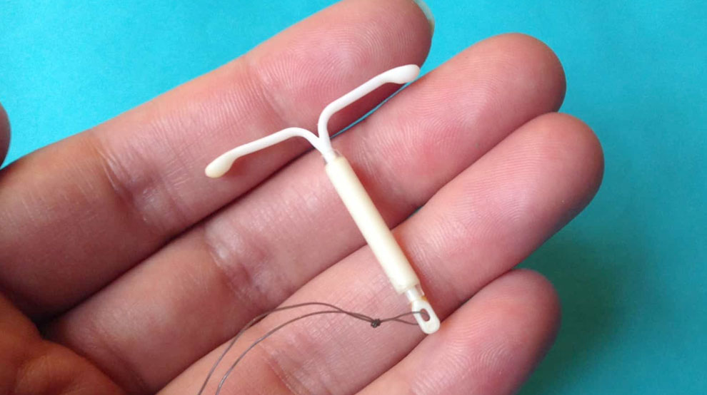 Review Perbedaan IUD Nova T dan Andalan, Mana yang Paling Bagus?