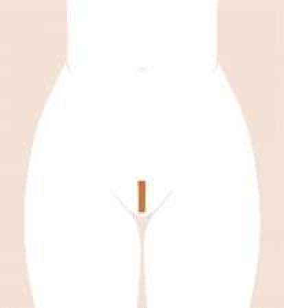 extended bokini