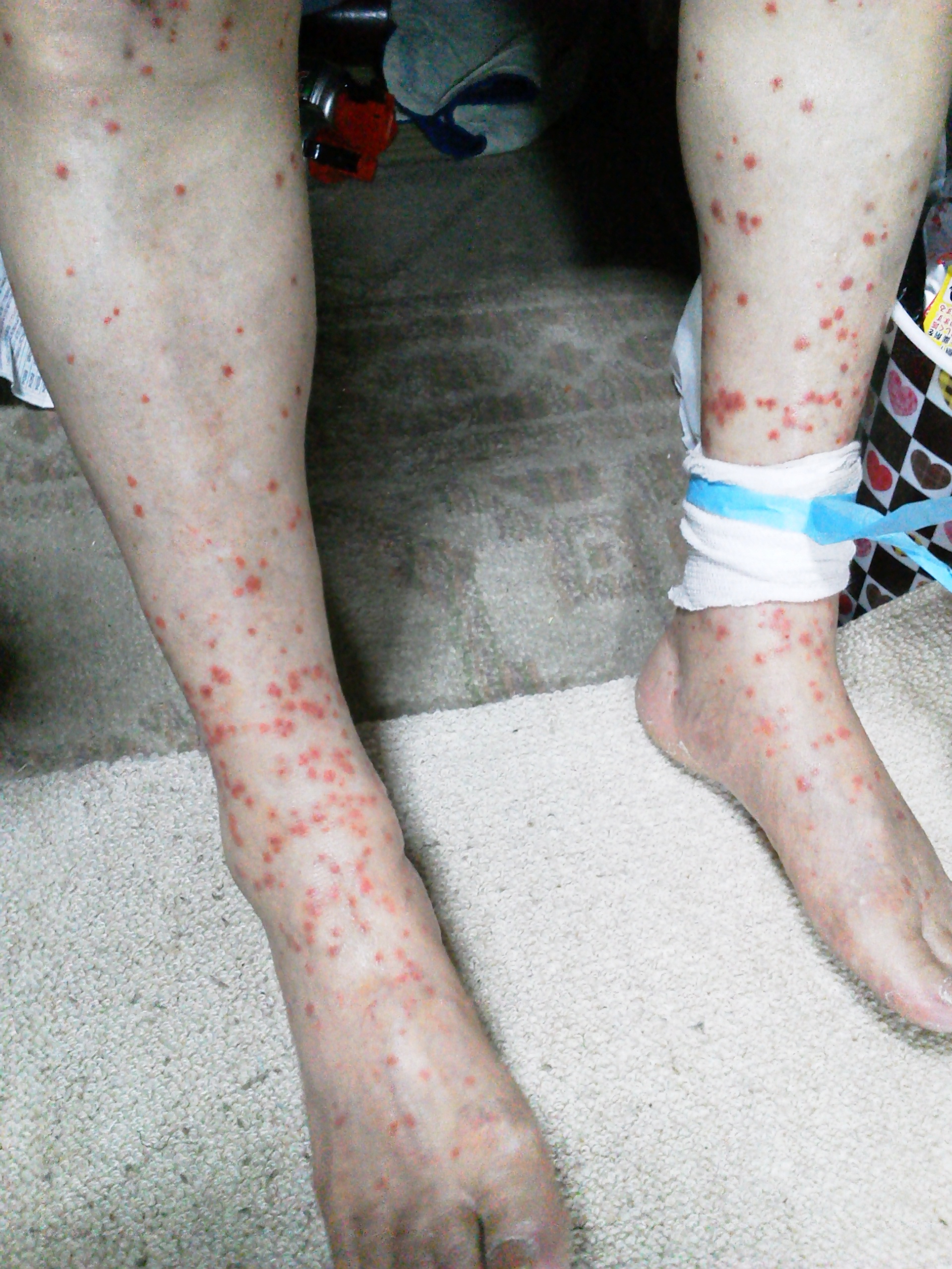 ネコノミの被害｜害虫バスターズ