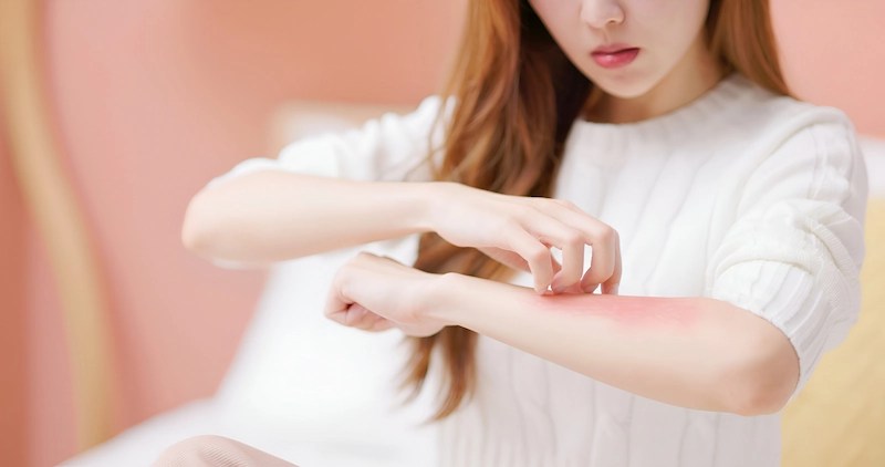biotin side effects